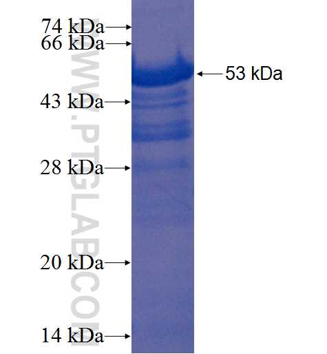 KLF15 fusion protein Ag4864 SDS-PAGE