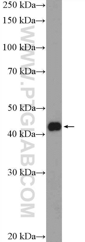 Western Blot (WB) analysis of MCF-7 cells using KLF17 Polyclonal antibody (17612-1-AP)