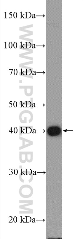 Western Blot (WB) analysis of MCF-7 cells using KLF17 Polyclonal antibody (17612-1-AP)