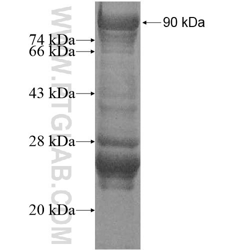 KLF17 fusion protein Ag11776 SDS-PAGE