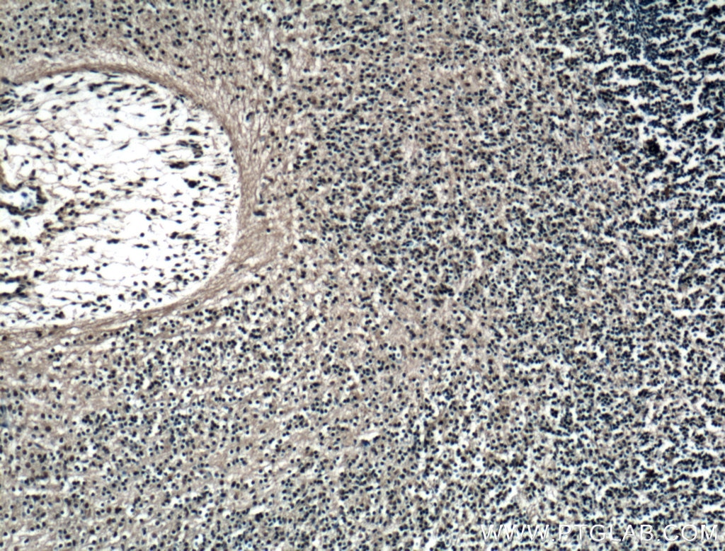 Immunohistochemistry (IHC) staining of mouse embryo tissue using KLF4 Polyclonal antibody (11880-1-AP)