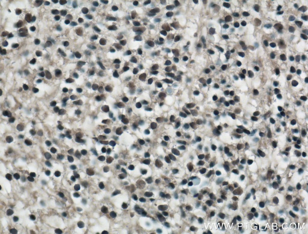 IHC staining of mouse embryo using 11880-1-AP