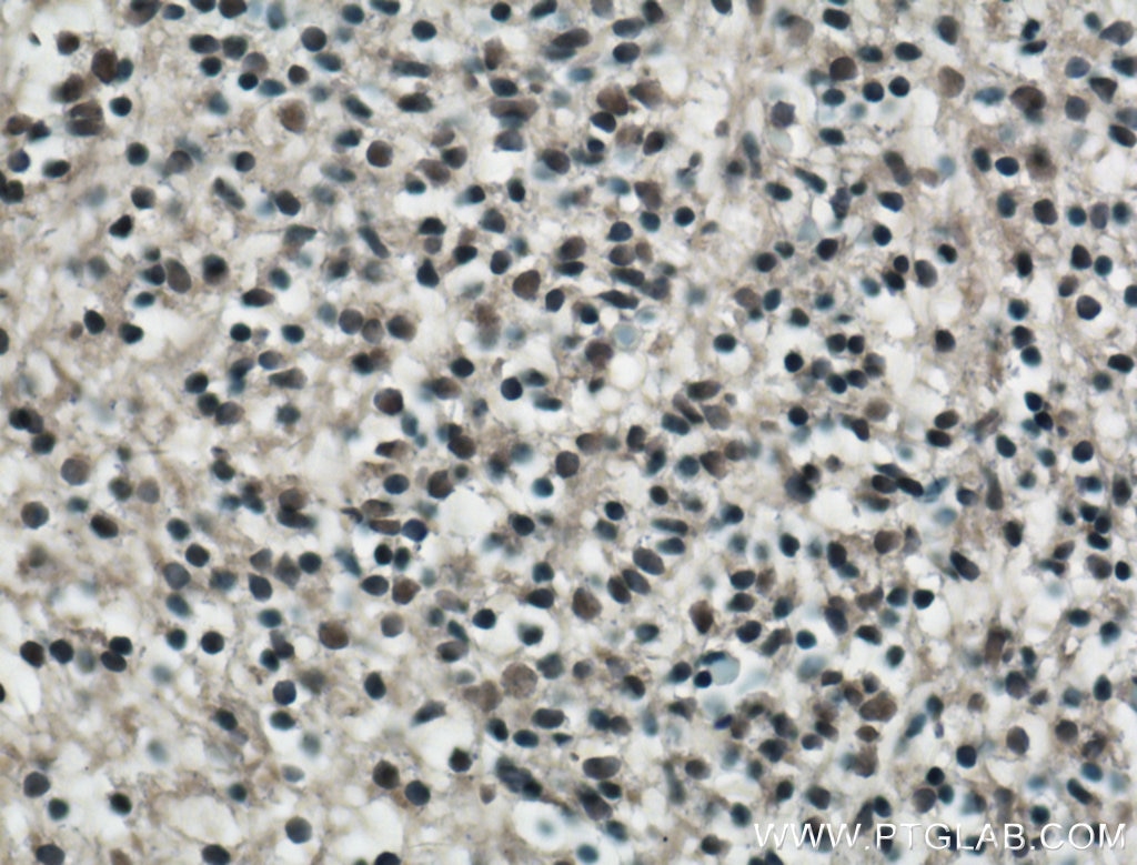 Immunohistochemistry (IHC) staining of mouse embryo tissue using KLF4 Polyclonal antibody (11880-1-AP)