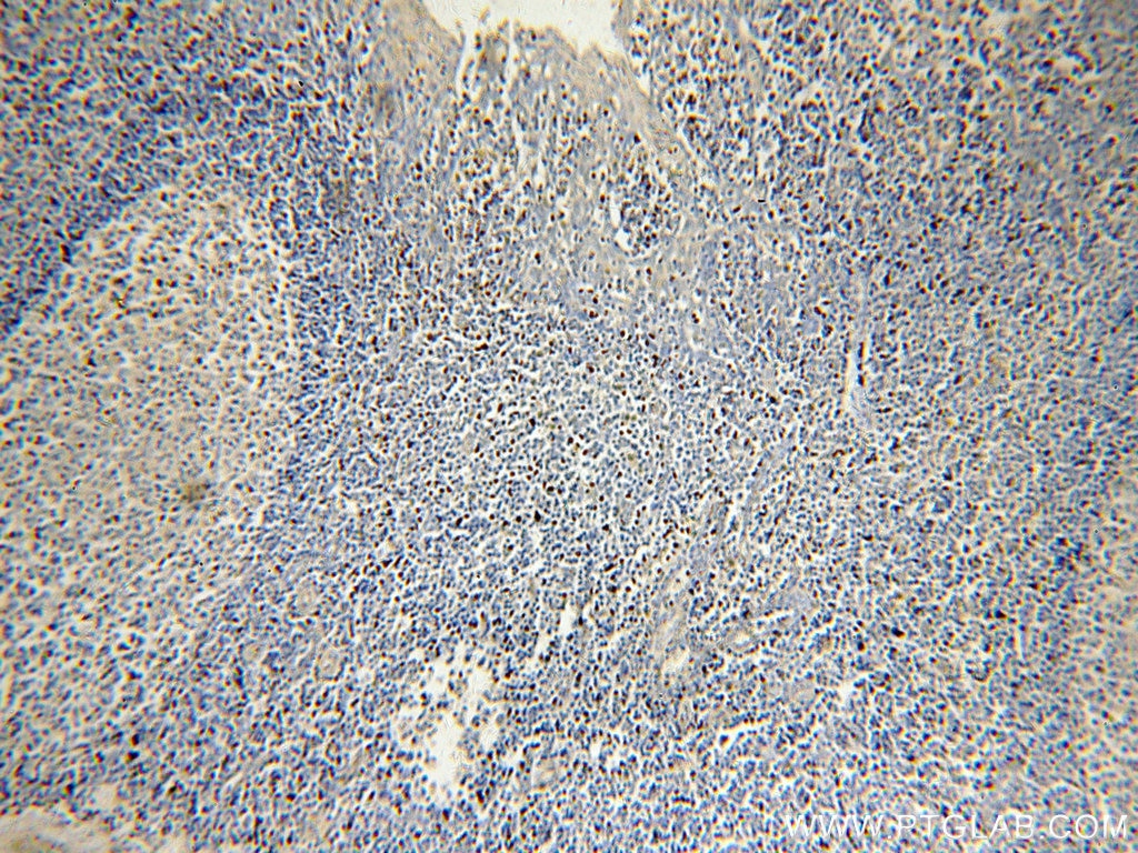 Immunohistochemistry (IHC) staining of human tonsil tissue using KLF4 Polyclonal antibody (11880-1-AP)