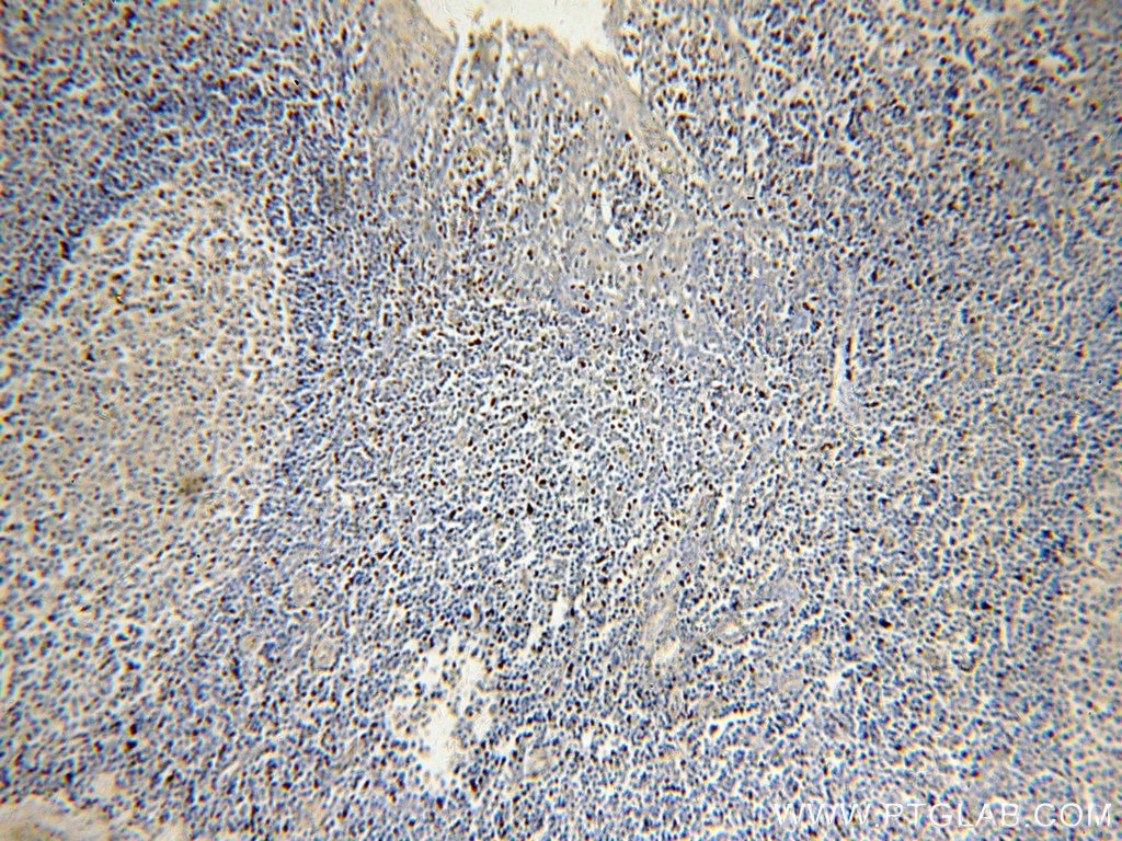 IHC staining of human tonsil using 11880-1-AP