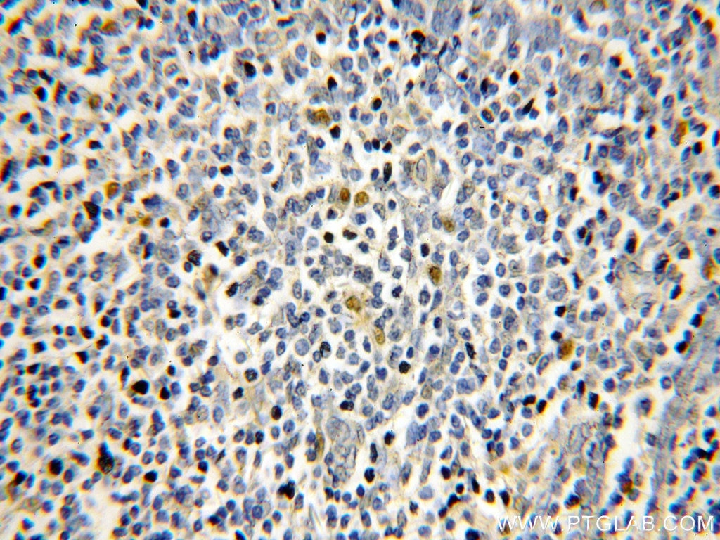 IHC staining of human tonsil using 11880-1-AP