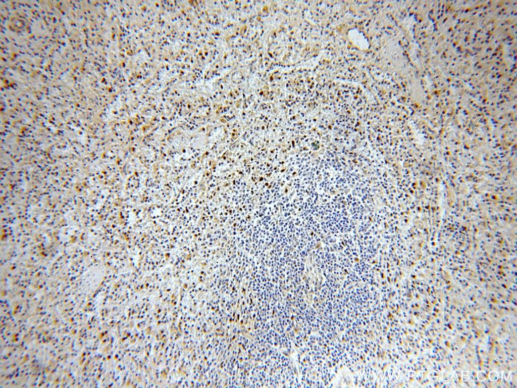 IHC staining of human spleen using 11880-1-AP