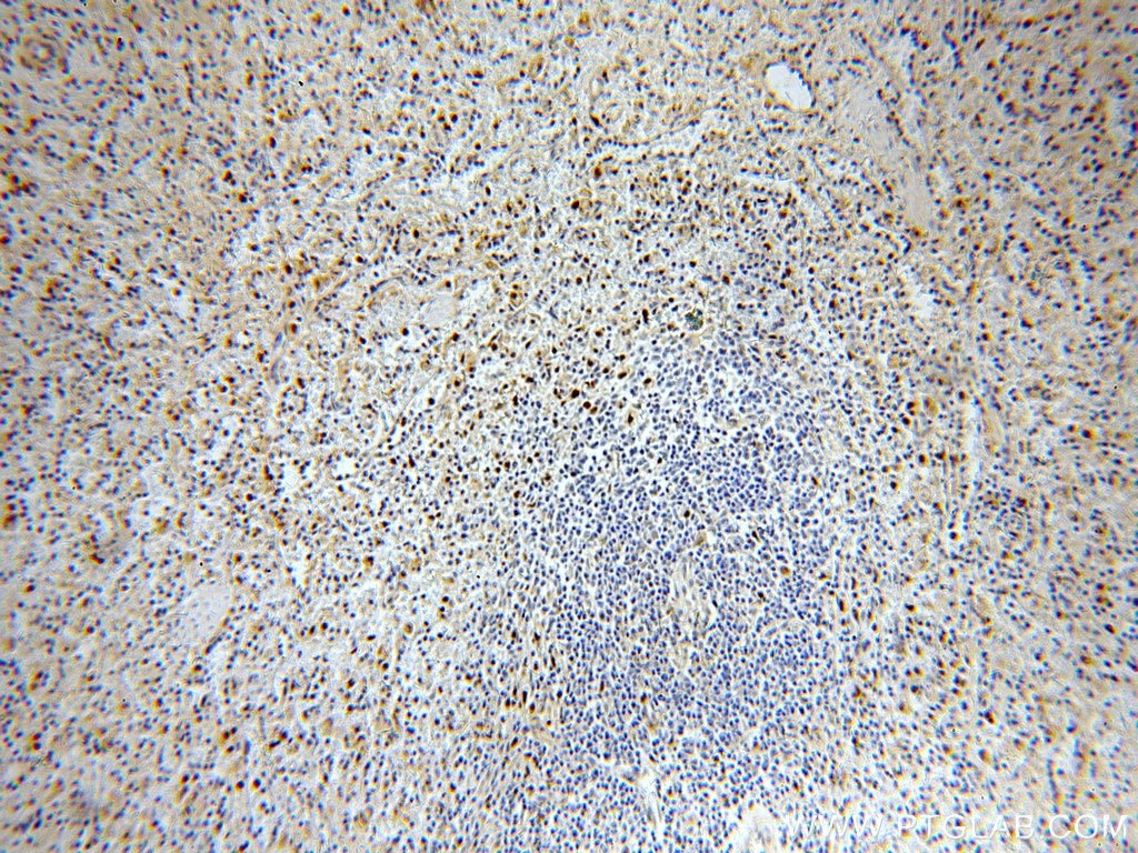 Immunohistochemistry (IHC) staining of human spleen tissue using KLF4 Polyclonal antibody (11880-1-AP)