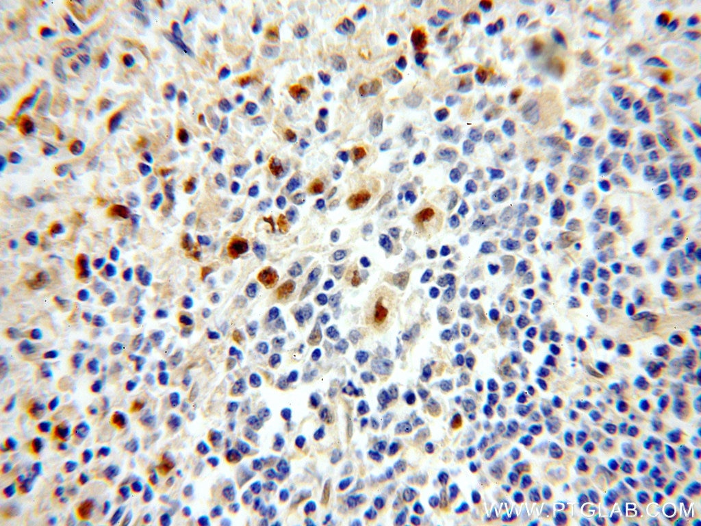 Immunohistochemistry (IHC) staining of human spleen tissue using KLF4 Polyclonal antibody (11880-1-AP)