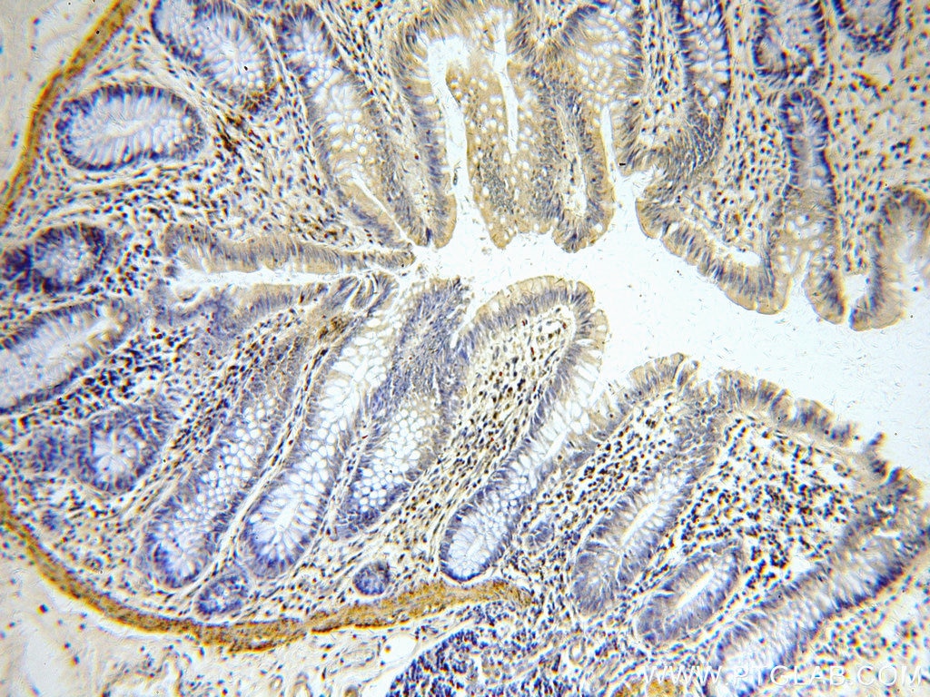 Immunohistochemistry (IHC) staining of human colon tissue using KLF4 Polyclonal antibody (11880-1-AP)