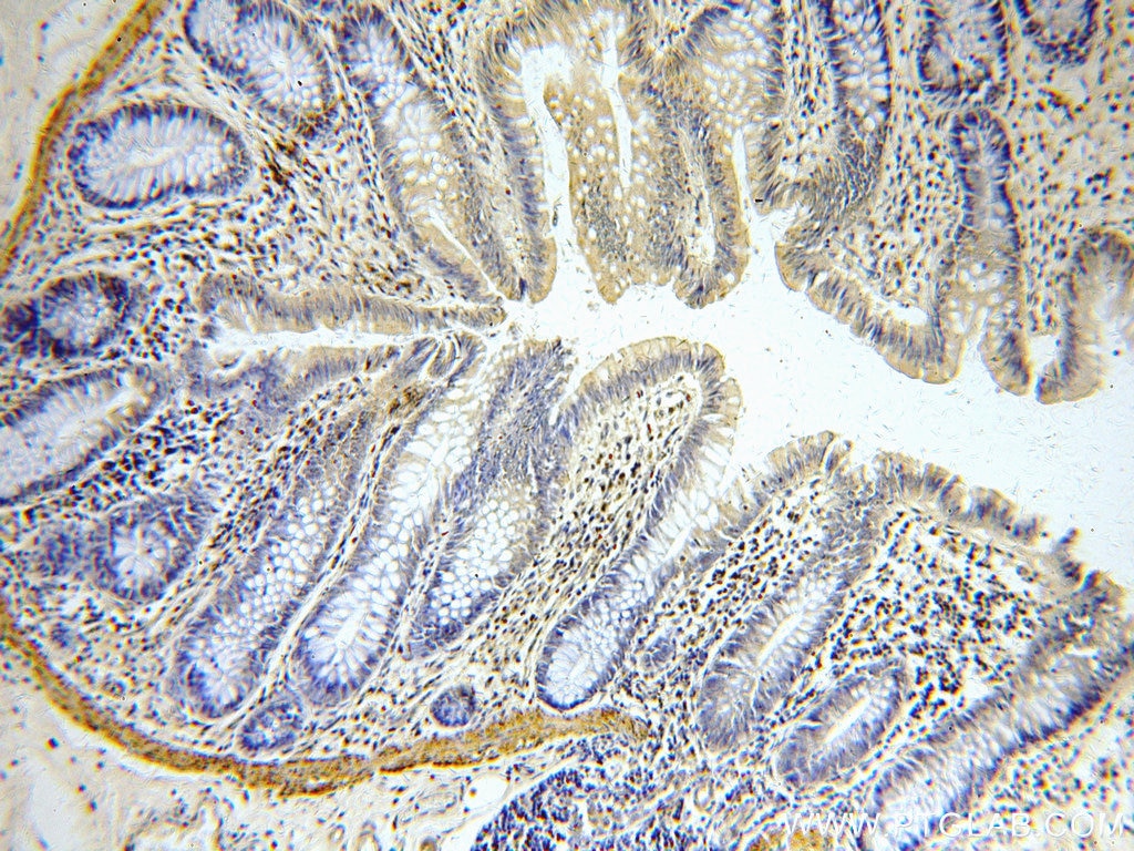 IHC staining of human colon using 11880-1-AP