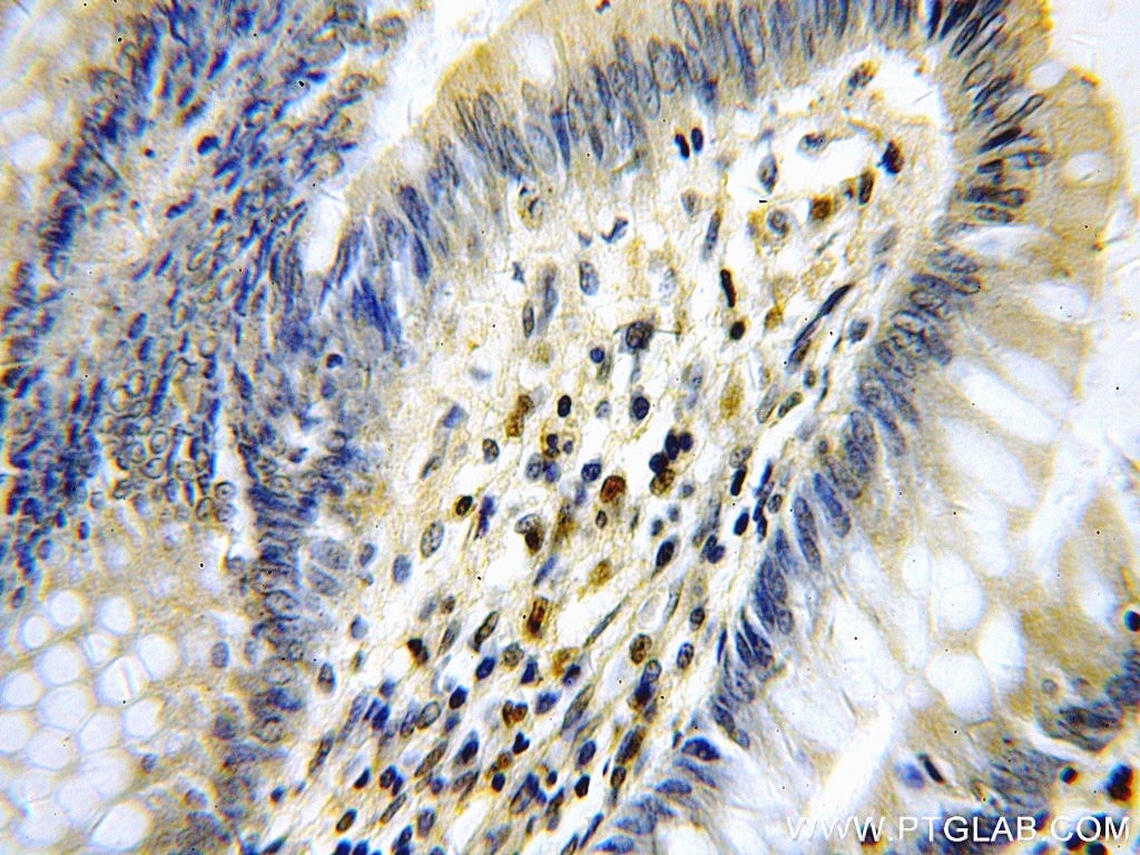 IHC staining of human colon using 11880-1-AP