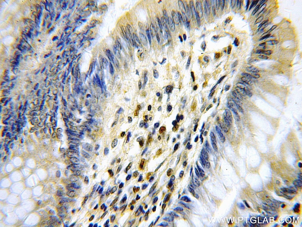 Immunohistochemistry (IHC) staining of human colon tissue using KLF4 Polyclonal antibody (11880-1-AP)