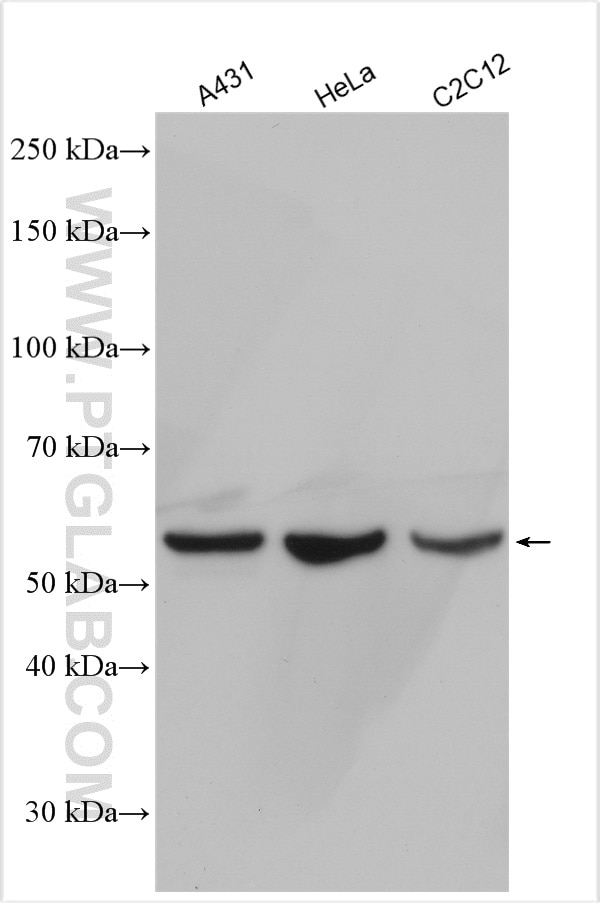 Western Blot (WB) analysis of various lysates using KLF4 Polyclonal antibody (11880-1-AP)