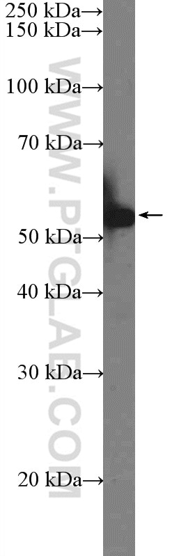 Western Blot (WB) analysis of NCCIT cells using KLF4 Polyclonal antibody (11880-1-AP)