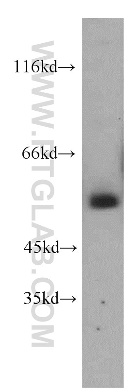 Western Blot (WB) analysis of HT-1080 cells using KLF4 Polyclonal antibody (11880-1-AP)