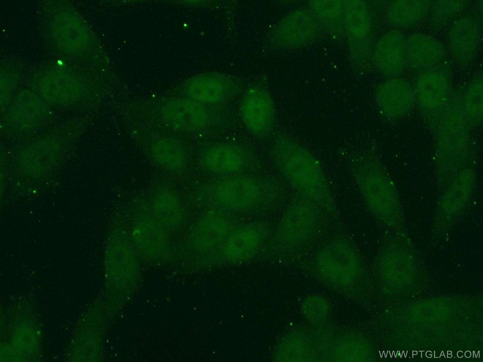 Immunofluorescence (IF) / fluorescent staining of HeLa cells using KLF5 Polyclonal antibody (21017-1-AP)