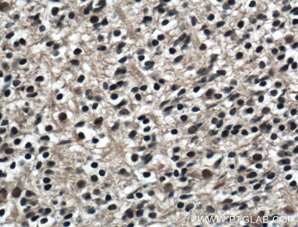 Immunohistochemistry (IHC) staining of mouse embryo tissue using KLF5 Polyclonal antibody (21017-1-AP)