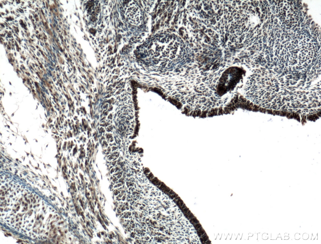 Immunohistochemistry (IHC) staining of mouse embryo tissue using KLF5 Polyclonal antibody (21017-1-AP)
