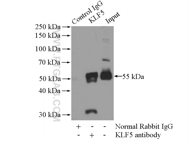 Immunoprecipitation (IP) experiment of HeLa cells using KLF5 Polyclonal antibody (21017-1-AP)