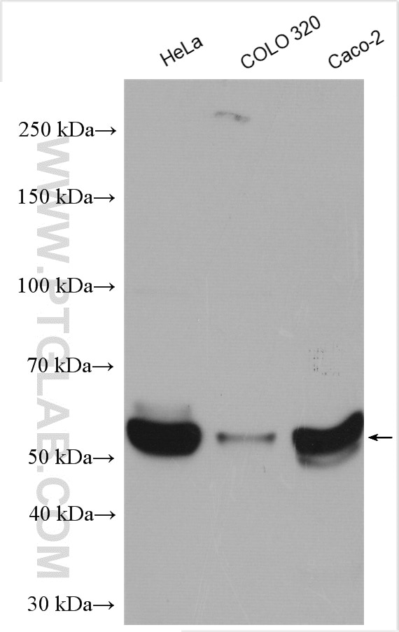 Western Blot (WB) analysis of various lysates using KLF5 Polyclonal antibody (21017-1-AP)