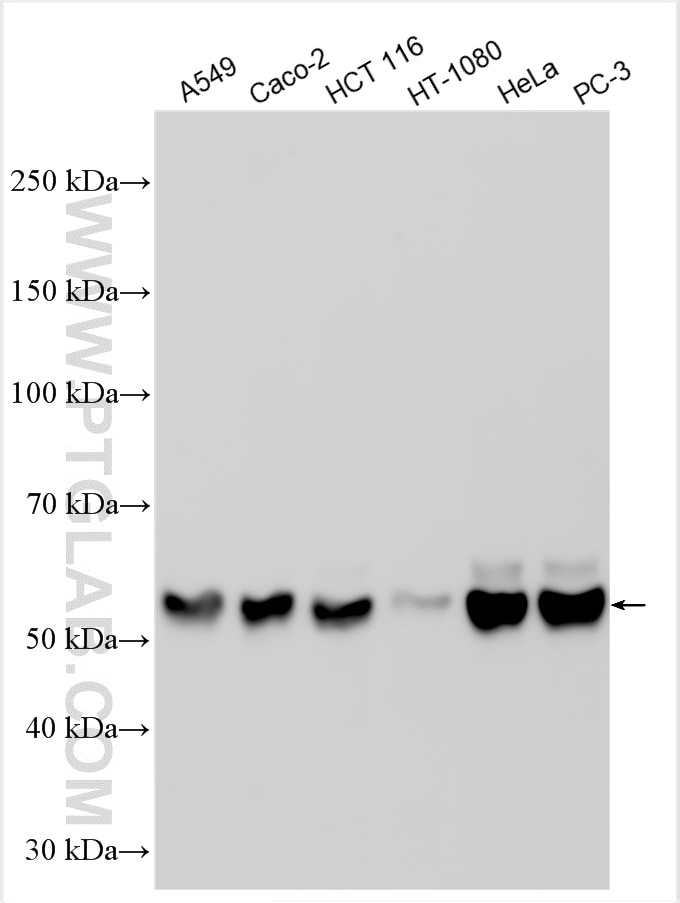 Western Blot (WB) analysis of various lysates using KLF5 Polyclonal antibody (21017-1-AP)