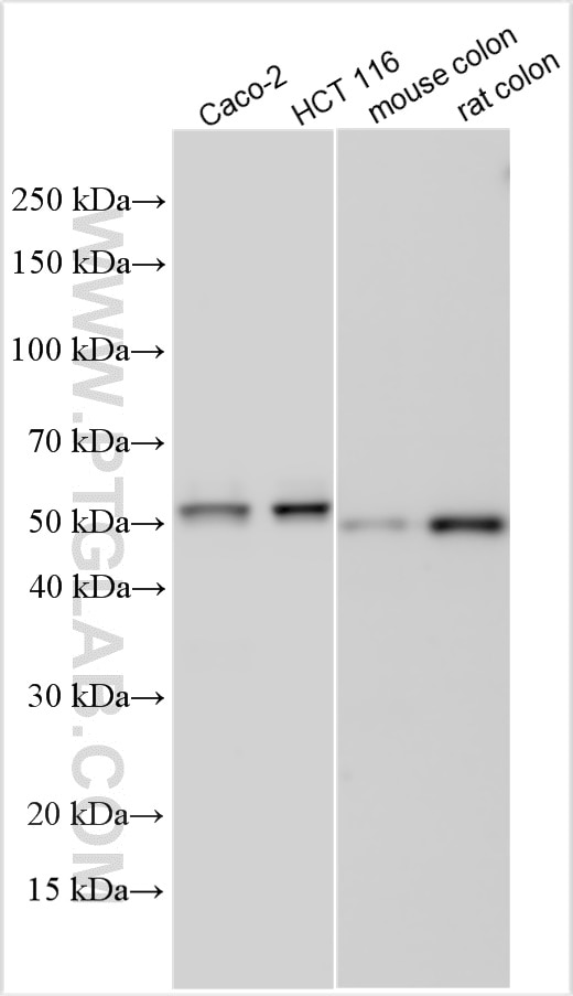 Western Blot (WB) analysis of various lysates using KLF5 Polyclonal antibody (21017-1-AP)