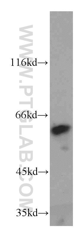 Western Blot (WB) analysis of A549 cells using KLF5 Polyclonal antibody (21017-1-AP)