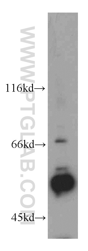 Western Blot (WB) analysis of mouse colon tissue using KLF5 Polyclonal antibody (21017-1-AP)