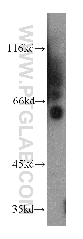 Western Blot (WB) analysis of human testis tissue using KLF5 Polyclonal antibody (21017-1-AP)