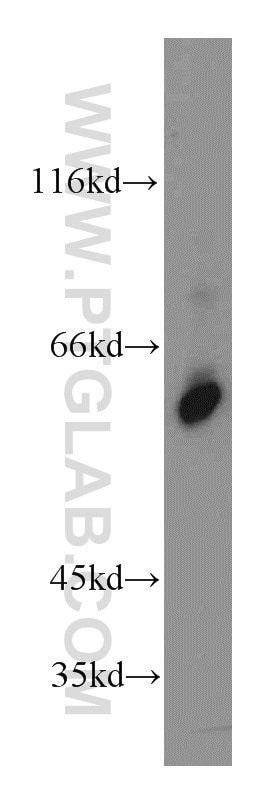 Western Blot (WB) analysis of PC-3 cells using KLF5 Polyclonal antibody (21017-1-AP)