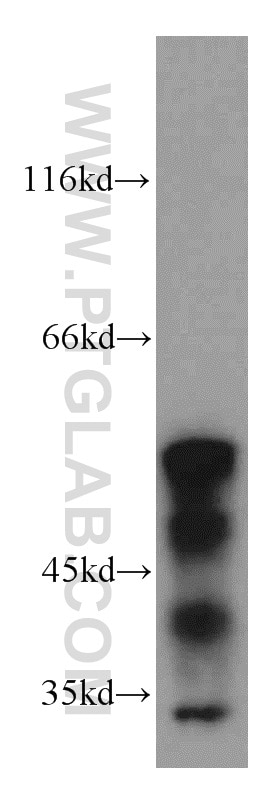 Western Blot (WB) analysis of mouse small intestine tissue using KLF5 Polyclonal antibody (21017-1-AP)