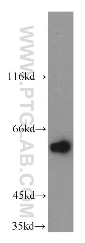 Western Blot (WB) analysis of A549 cells using KLF5 Polyclonal antibody (21017-1-AP)