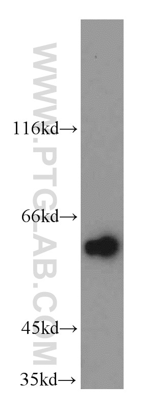 WB analysis of A549 using 21017-1-AP