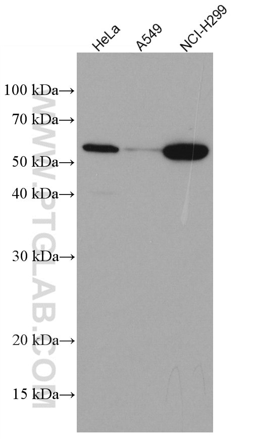 Western Blot (WB) analysis of various lysates using KLF5 Monoclonal antibody (66850-1-Ig)