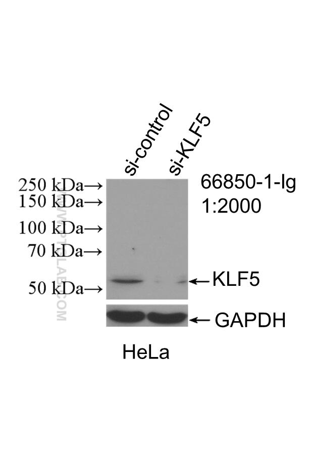 Western Blot (WB) analysis of HeLa cells using KLF5 Monoclonal antibody (66850-1-Ig)