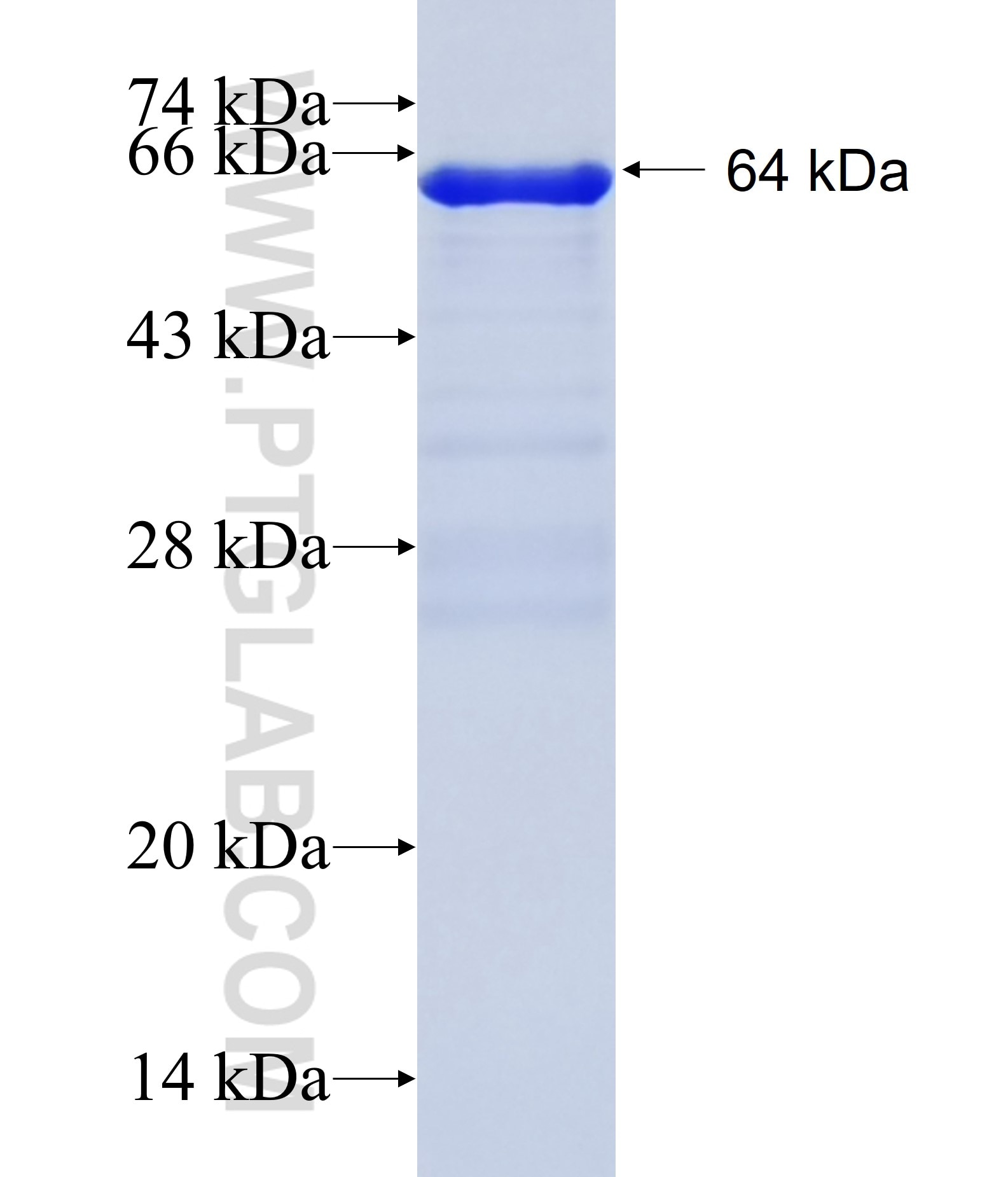 KLF5 fusion protein Ag15267 SDS-PAGE