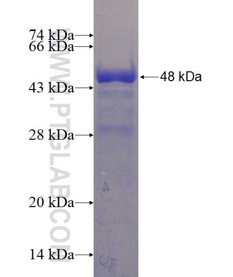 KLF5 fusion protein Ag15403 SDS-PAGE