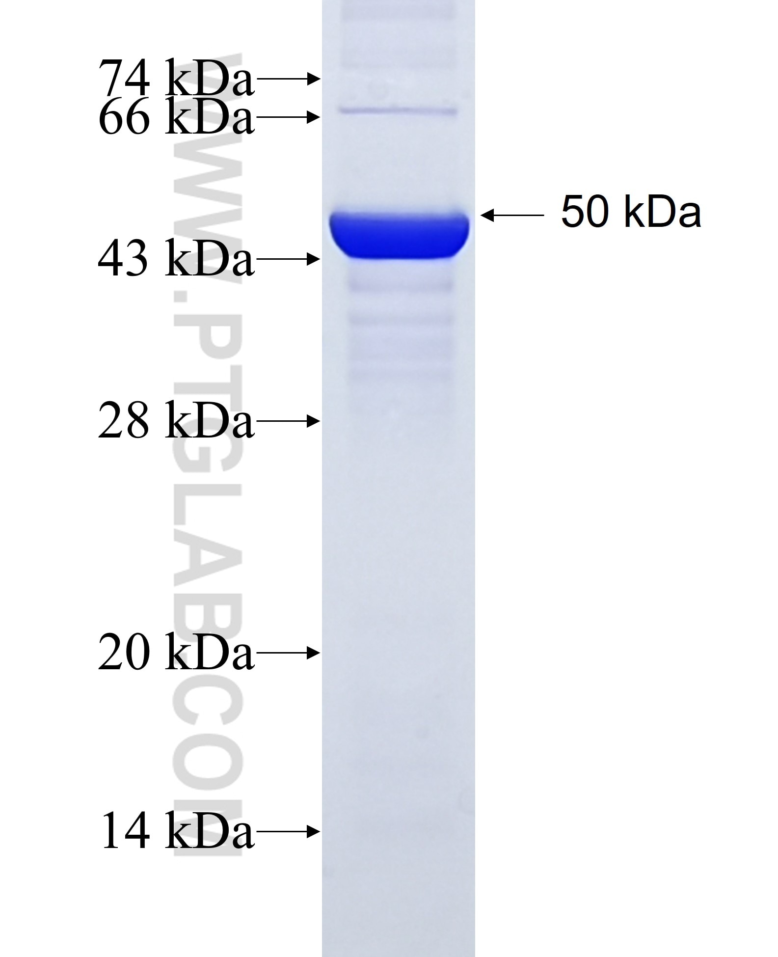 KLF5 fusion protein Ag15403 SDS-PAGE