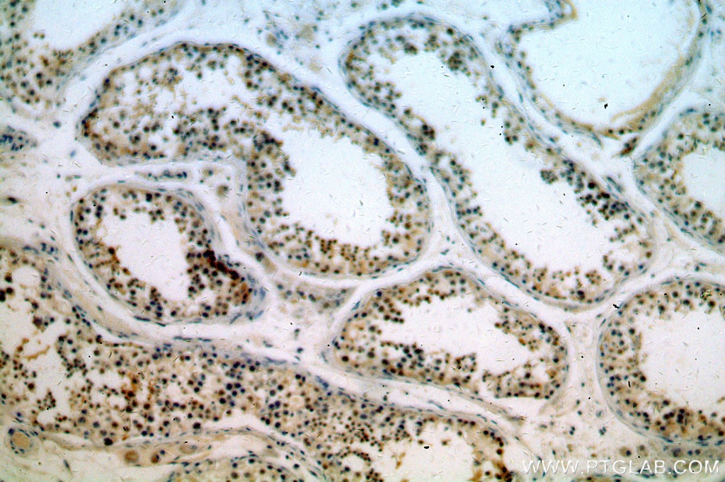 Immunohistochemistry (IHC) staining of human testis tissue using KLF6 Polyclonal antibody (14716-1-AP)