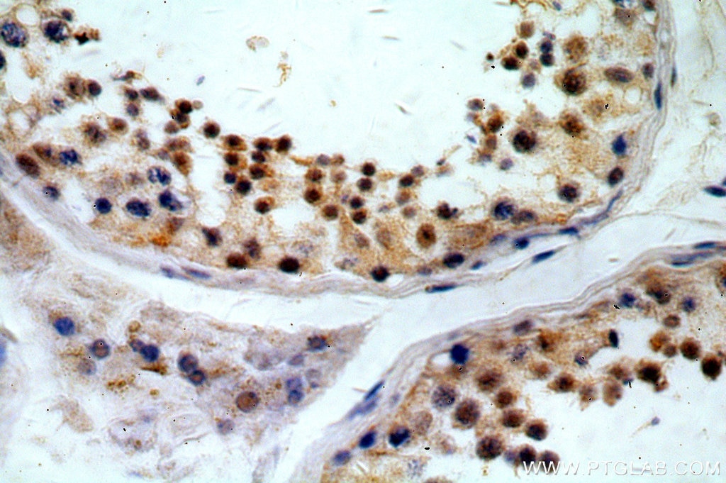 Immunohistochemistry (IHC) staining of human testis tissue using KLF6 Polyclonal antibody (14716-1-AP)