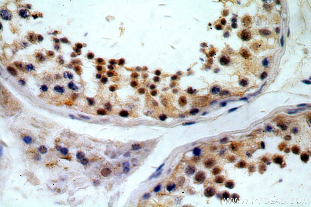 IHC staining of human testis using 14716-1-AP