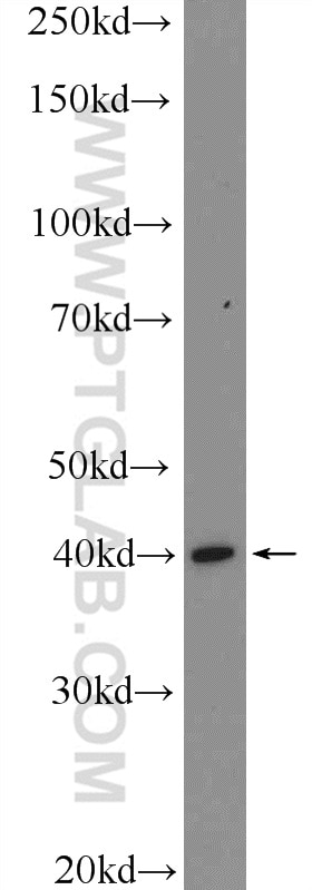 Western Blot (WB) analysis of human placenta tissue using KLF6 Polyclonal antibody (14716-1-AP)