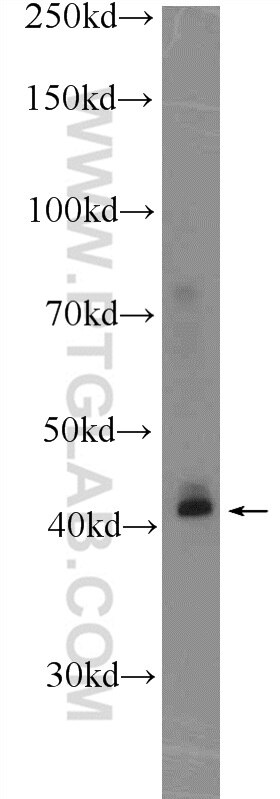 Western Blot (WB) analysis of mouse colon tissue using KLF6 Polyclonal antibody (14716-1-AP)