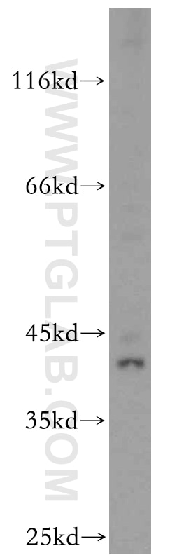 Western Blot (WB) analysis of HEK-293 cells using KLF6 Polyclonal antibody (14716-1-AP)