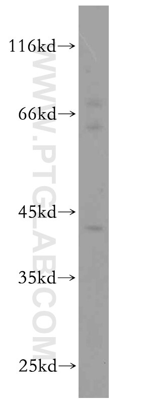 Western Blot (WB) analysis of mouse testis tissue using KLF6 Polyclonal antibody (14716-1-AP)