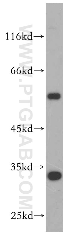 Western Blot (WB) analysis of PC-3 cells using KLF6 Polyclonal antibody (14716-1-AP)