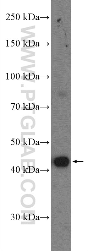 Western Blot (WB) analysis of HeLa cells using KLHDC1 Polyclonal antibody (27277-1-AP)