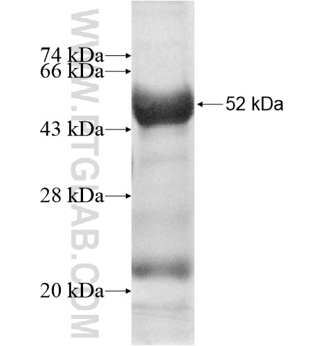 KLHDC2 fusion protein Ag10951 SDS-PAGE