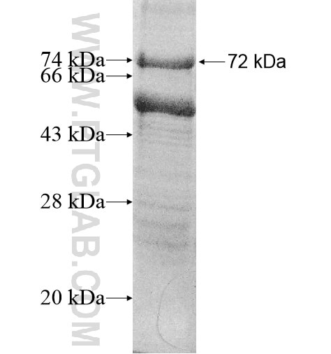 KLHDC2 fusion protein Ag10976 SDS-PAGE